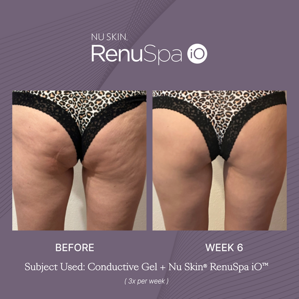 nu-skin-renuspa-io-before-after-body-image